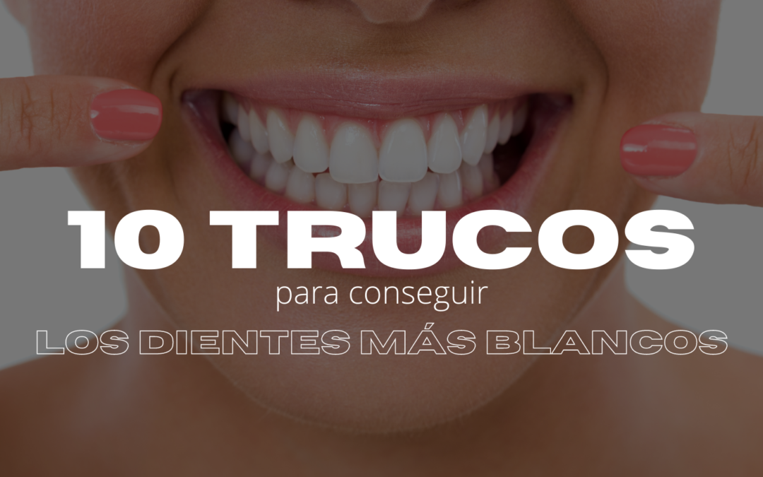 10 trucos para conseguir los dientes más blancos