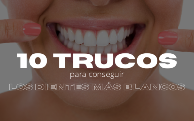 10 trucos para conseguir los dientes más blancos