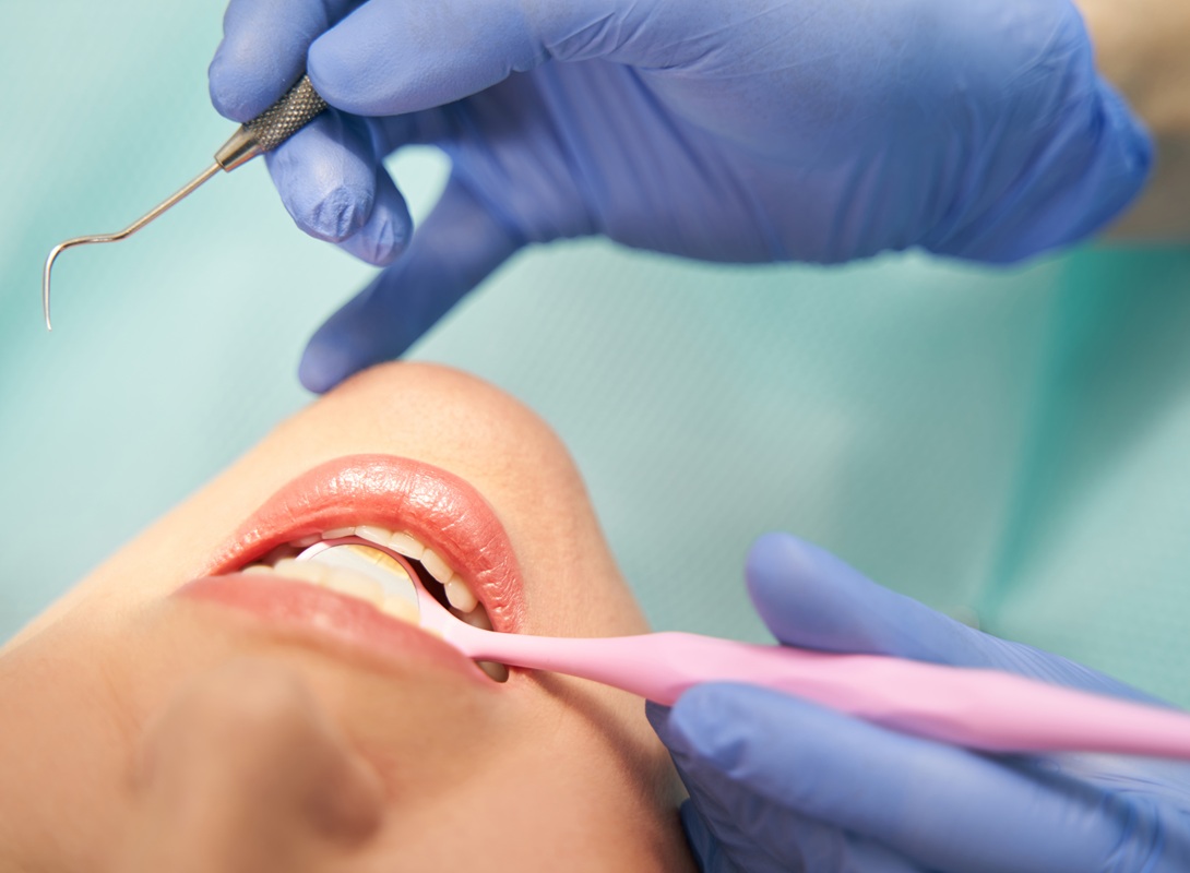 Tratamiento de periodoncia y limpieza profunda