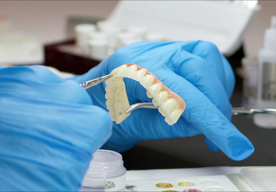 Prótesis dental fija sobre implantes